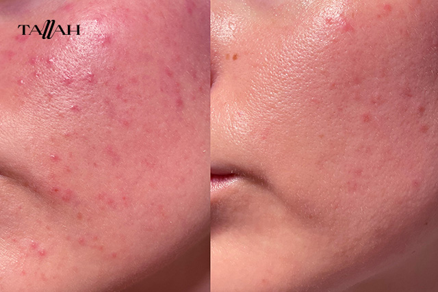 ريفيو عن كريم اكرين