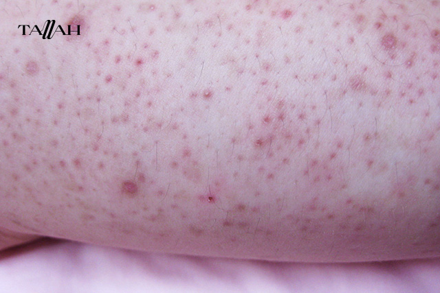 شكل جلد الوزة