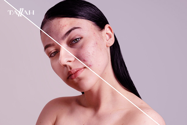 كيف أجعل بشرتي تلمع كالزجاج؟ 