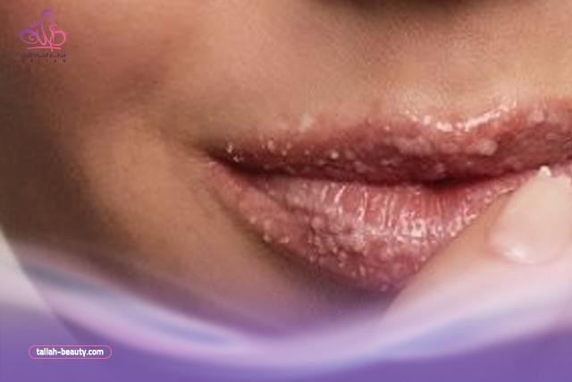 سكراب-للشفايف-1
