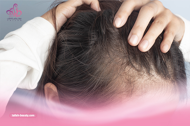  فوائد الثوم للشعر الخفيف