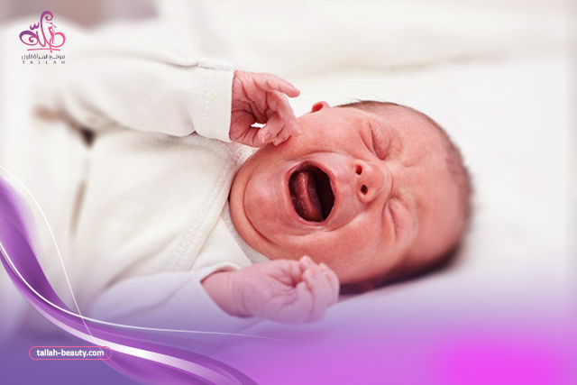 علاج-تسلخات-الأطفال الشديدة-