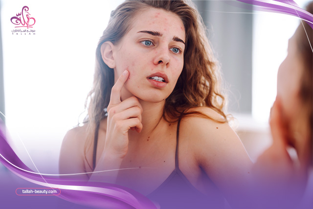 اسباب-خلل-الهرمونات-عند النساء-