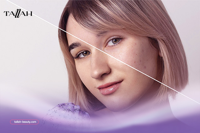 علاج-أكسدة-البشرة 