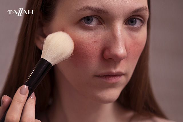 تنت ايتود هاوس