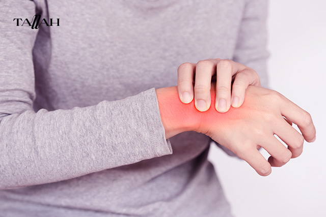 أعراض النقرس في اليدين