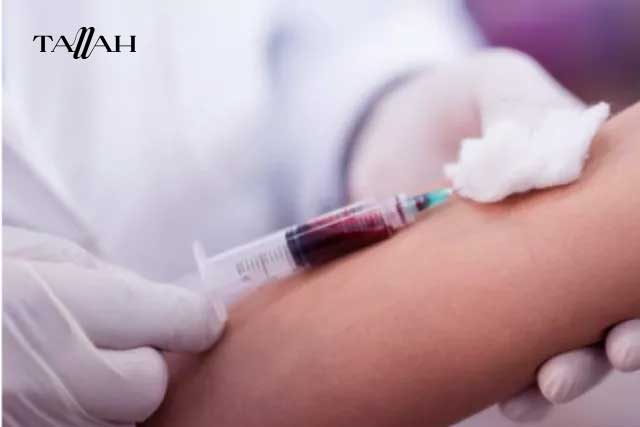 تحليل نقص المناعة