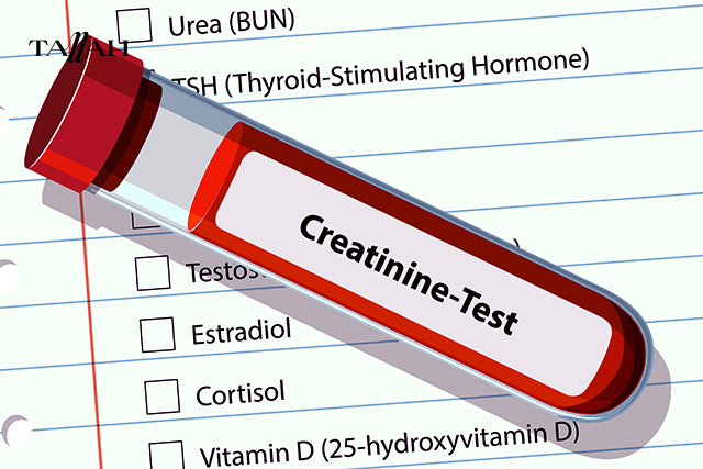 علاج ارتفاع وظائف الكلى 