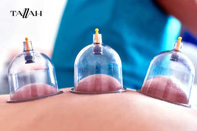 فوائد الحجامة