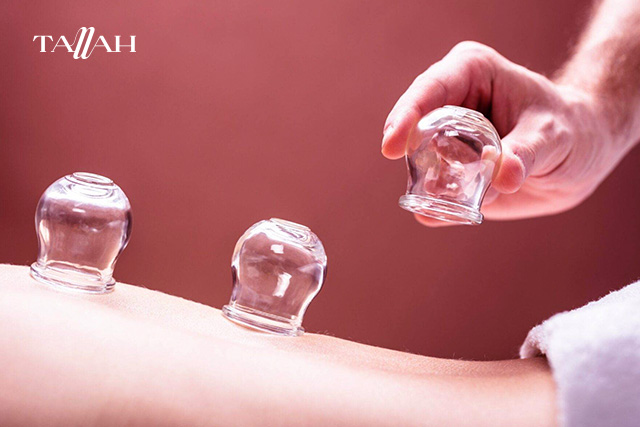 طريقة عمل الحجامة