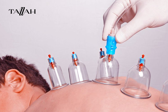 اماكن الحجامة في الجسم