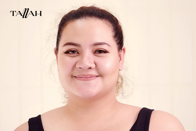 متى ينتهي مفعول إبرة الكورتيزون