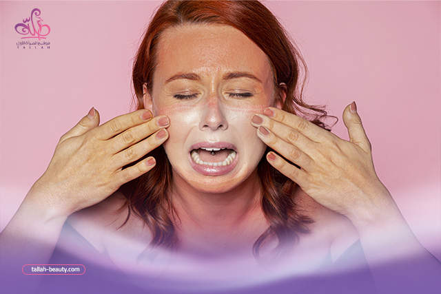 علاج حروق الشمس من المصيف والوقاية منها