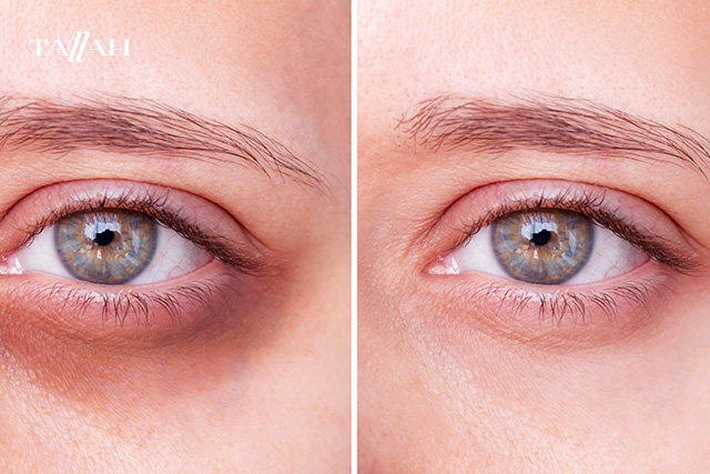 أفضل 5 أنواع كريم عين في الصيدليات