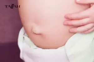 ​​اسباب بروز السرة عند الاطفال حديثي الولادة