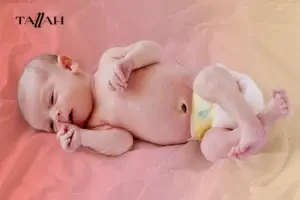 أسباب فتق السرة عند الرضع