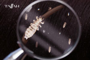 علاج القمل في المنزل للكبار