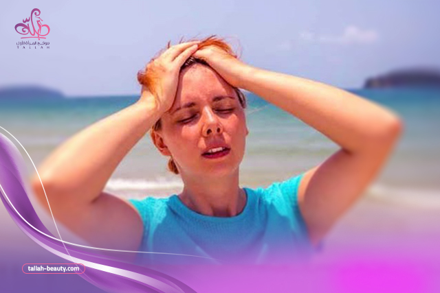 كيفية-علاج-ضربة-الشمس-في البيت-