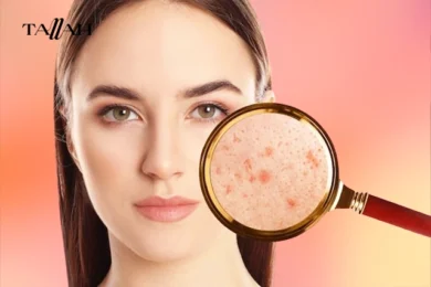 طرق علاج حاجز البشرة المتضرر