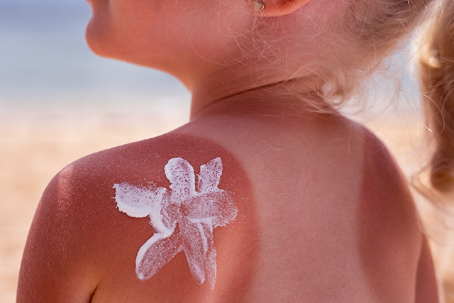 مميزات وعيوب صن بلوك بلانكي