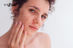 أنواع غسول نيتروجينا ديب كلين: