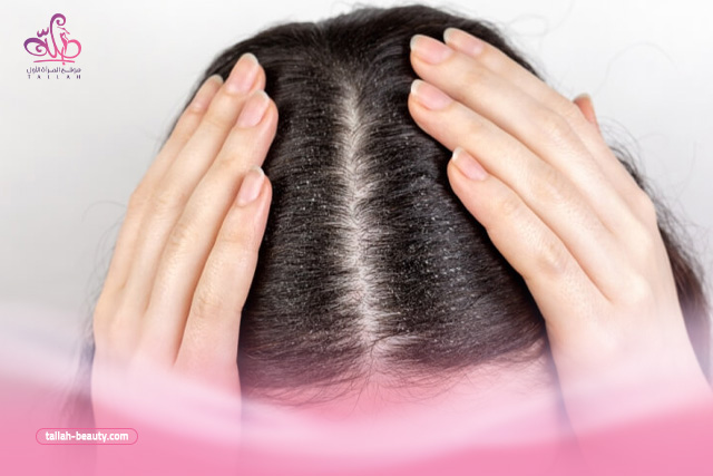 ما هو أفضل شامبو طبي للقشرة وتساقط الشعر؟