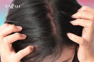 علاج التهاب فروة الرأس في المنزل