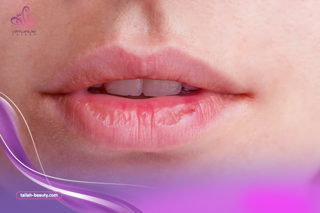 3 طرق لتوريد الشفايف في المنزل بمكونات بسيطة