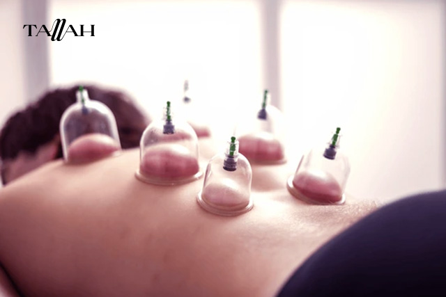 المحظورات بعد الحجامة