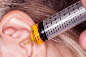 سرنجة تنظيف الاذن
