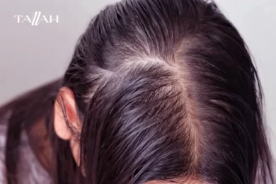 كم يدوم مفعول لوريال ماجيك ريتاتش؟