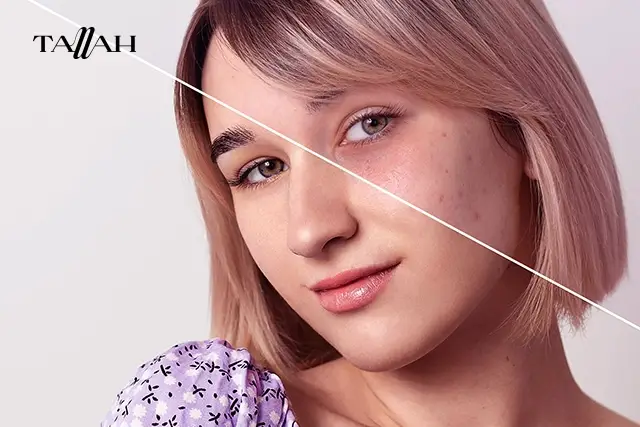 كريم سيول 1988 للهالات