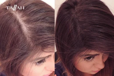 ما هو لون لوريال ماجيك ريتاتش سبراي بني غامق؟