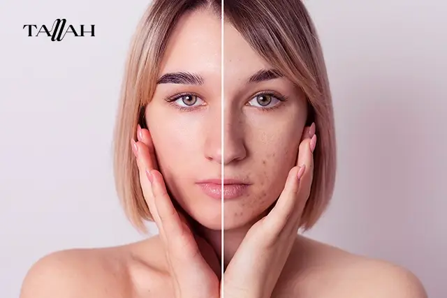 ريفيو عن ريتينال شوت سليماكس