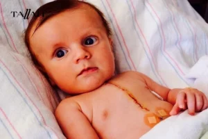 متى يغلق ثقب القلب عند الاطفال