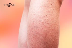 ما هو الفرق بين جلد الوزة وشعر تحت الجلد؟