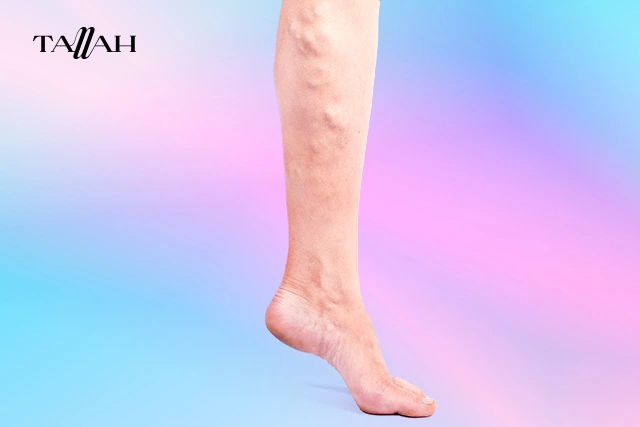 اعراض جلطة الرجل