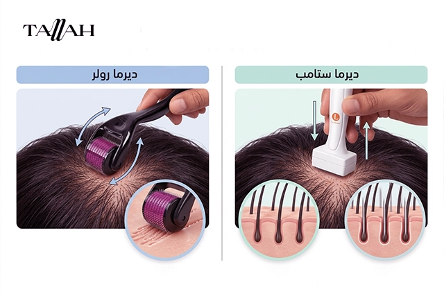 الفرق بين ديرما رولر وديرما ستامب للشعر