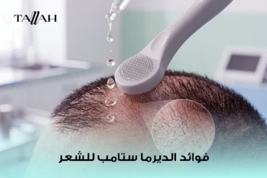 فوائد الديرما ستامب للشعر